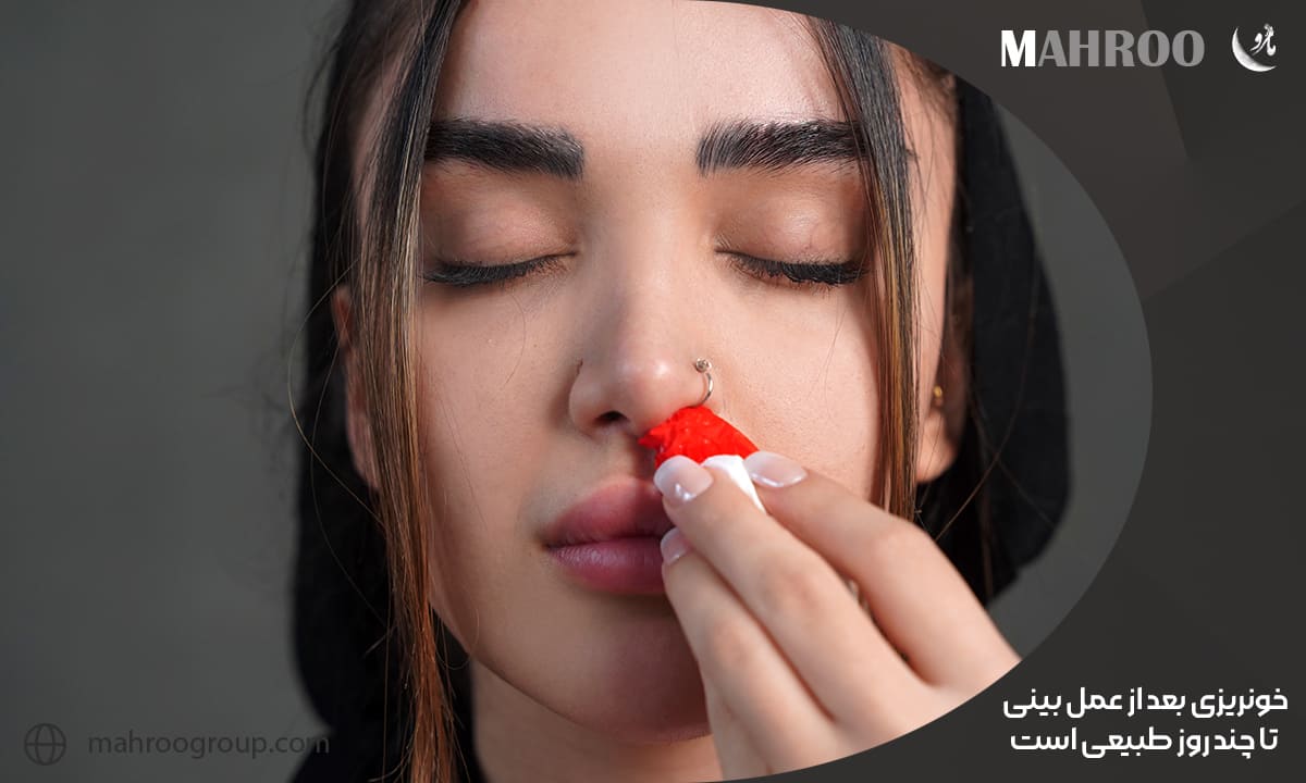 خونریزی بعد از عمل بینی تا چند روز طبیعی است
